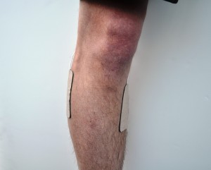 Jeff's leg